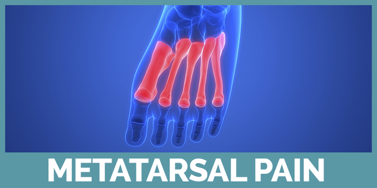 See our guides about metatarsal pain