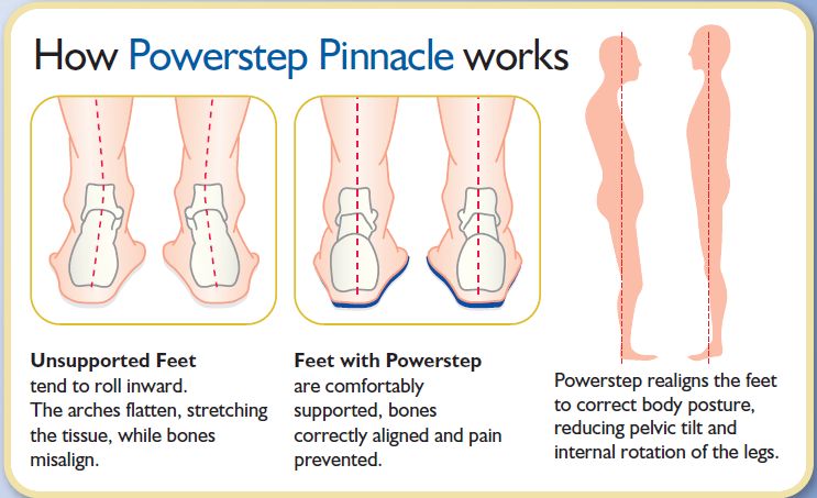 Benefits of the Powerstep Pinnacle Insoles