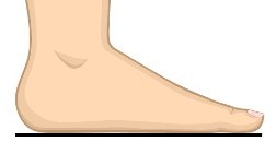 low arch foot