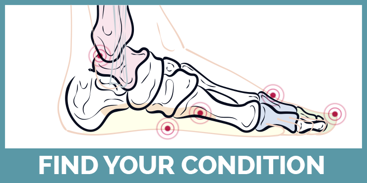 Find your foot condition with our guide!