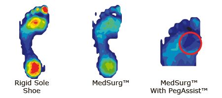 Darco Medsurg Post-Operative Shoe pressure relief diagram