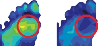 Darco Peg Assist Pressure Mapping