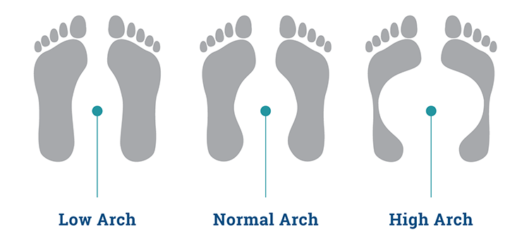 Types of Foot Arch