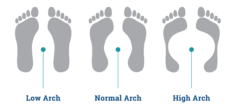 Types of Foot Prints