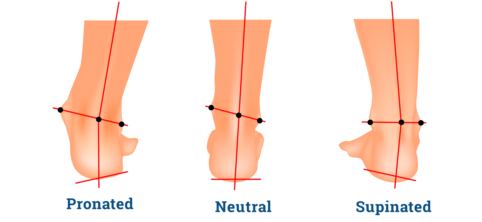 Know Your Arches