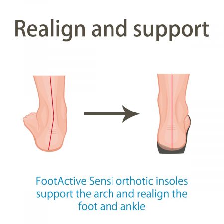 Realign and correctly position your feet and ankles FootActive Sensi Insoles