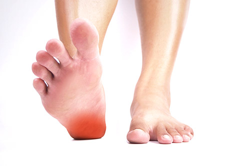 best insoles for calluses on balls of feet