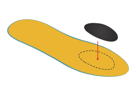 Place your pad with the tapered end towards the heel Metatarsal Pad Placement Diagram
