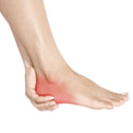 Best Insoles for Heel Pain 2024