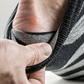 How to Treat Blisters