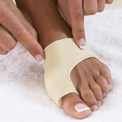 How to Treat Bunions