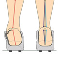 Best Insoles for Overpronation 2021