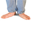 What are Flat Feet?