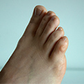 How to Stop Shoes Rubbing on Your Little Toe