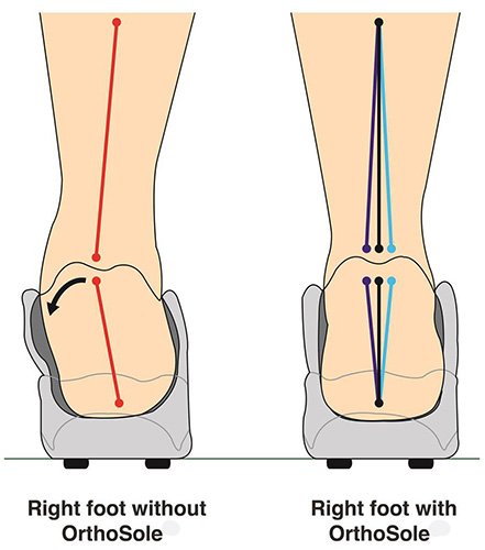 boots foot insoles