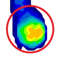 Standard Post-Op Shoe Pressure Scan