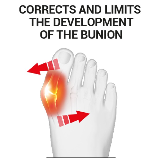 Epitact Flexible Bunion Corrector - Day Use - ShoeInsoles.co.uk