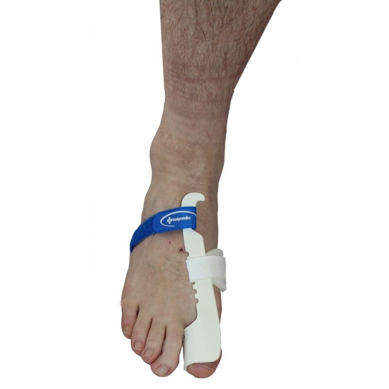 The Hallux Valgus Night Splint Works To Promote Big Toe Alignment