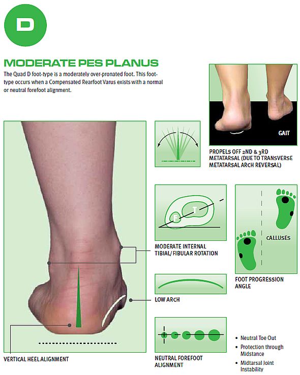 custom orthotics for overpronation