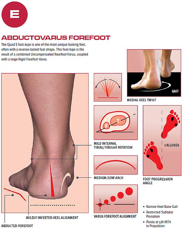 Insoles for on sale inverted feet