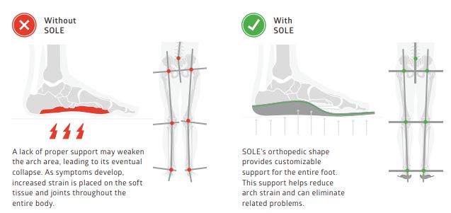 SOLE Footbed Insoles Benefits