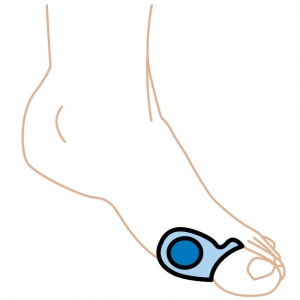 Silipos Gel Guard Bunion Protector for Shoes (5 Pack)