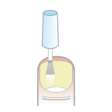 Using the Protect Air Nail Fungus Kit