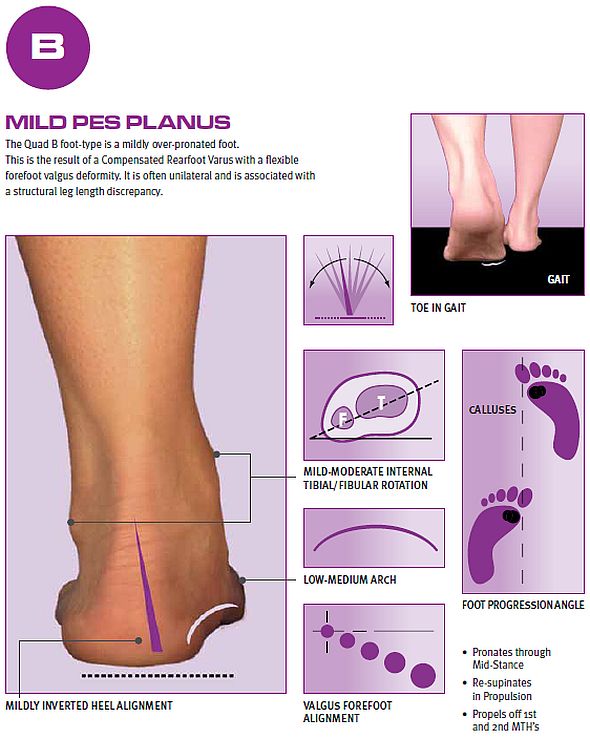 Quadrastep B Mild Over Pronation Insole 