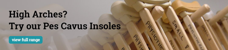 What is Pes Cavus?
